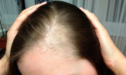 مجموعة السبع زيوت - تكثيف و أنبات و تطويل الشعر - 30 مللي