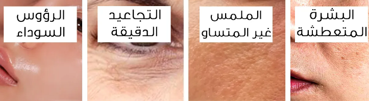 سيروم الهيالورونيك و النياسيناميد - 30 مللي