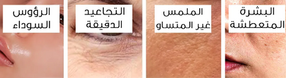 سيروم الهيالورونيك و النياسيناميد - 30 مللي